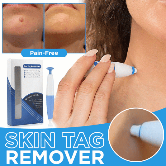 Skin-tag verwijderaar | Verwijder Gemakkelijk, Snel en Pijnloos Skin-Tags