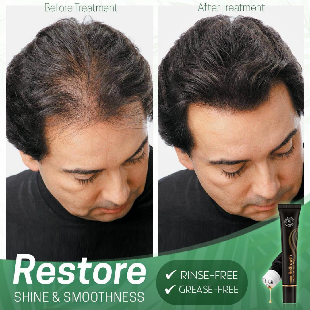 Regrow Haarserum™ | 1+1 GRATIS