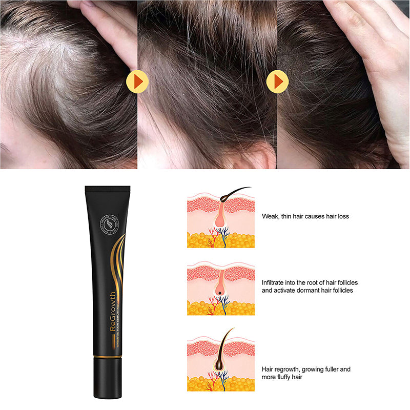 Regrow Haarserum™ | 1+1 GRATIS