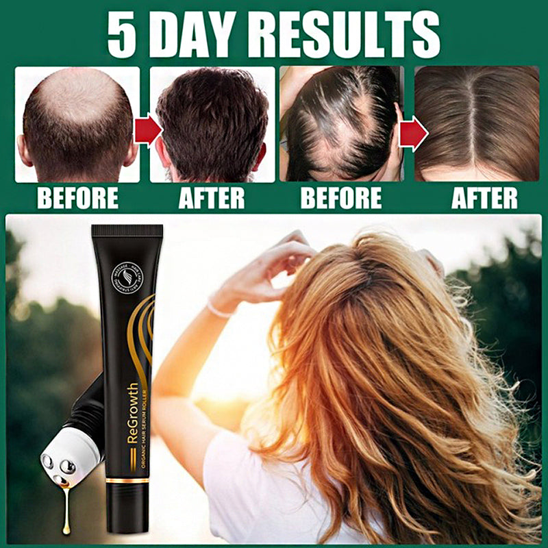 Regrow Haarserum™ | 1+1 GRATIS