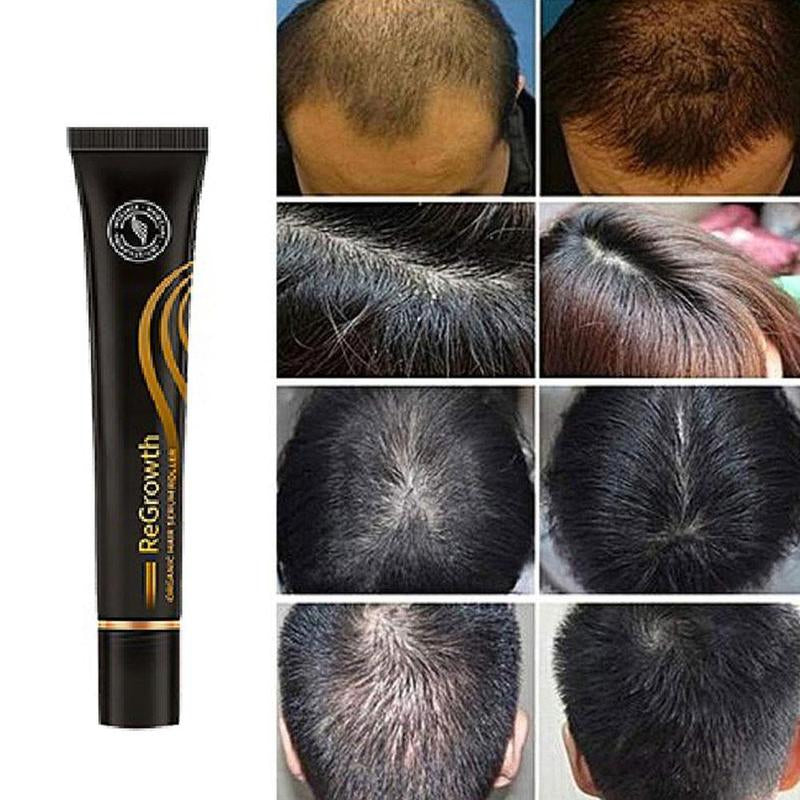 Regrow Haarserum™ | 1+1 GRATIS