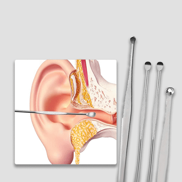 Oorsmeer verwijderaar set™