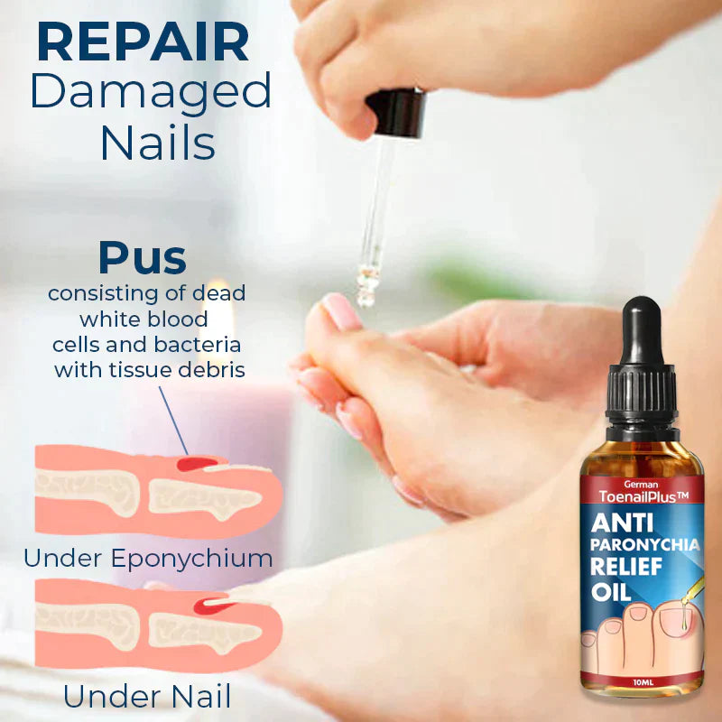 NailPlus™ Anti Paronychia Olie